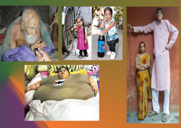 ये हैं दुनिया के ऐसे अजब गजब लोग, जिन्हें देखकर आप रह जायेंगे दंग