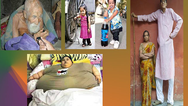 ये हैं दुनिया के ऐसे अजब गजब लोग, जिन्हें देखकर आप रह जायेंगे दंग